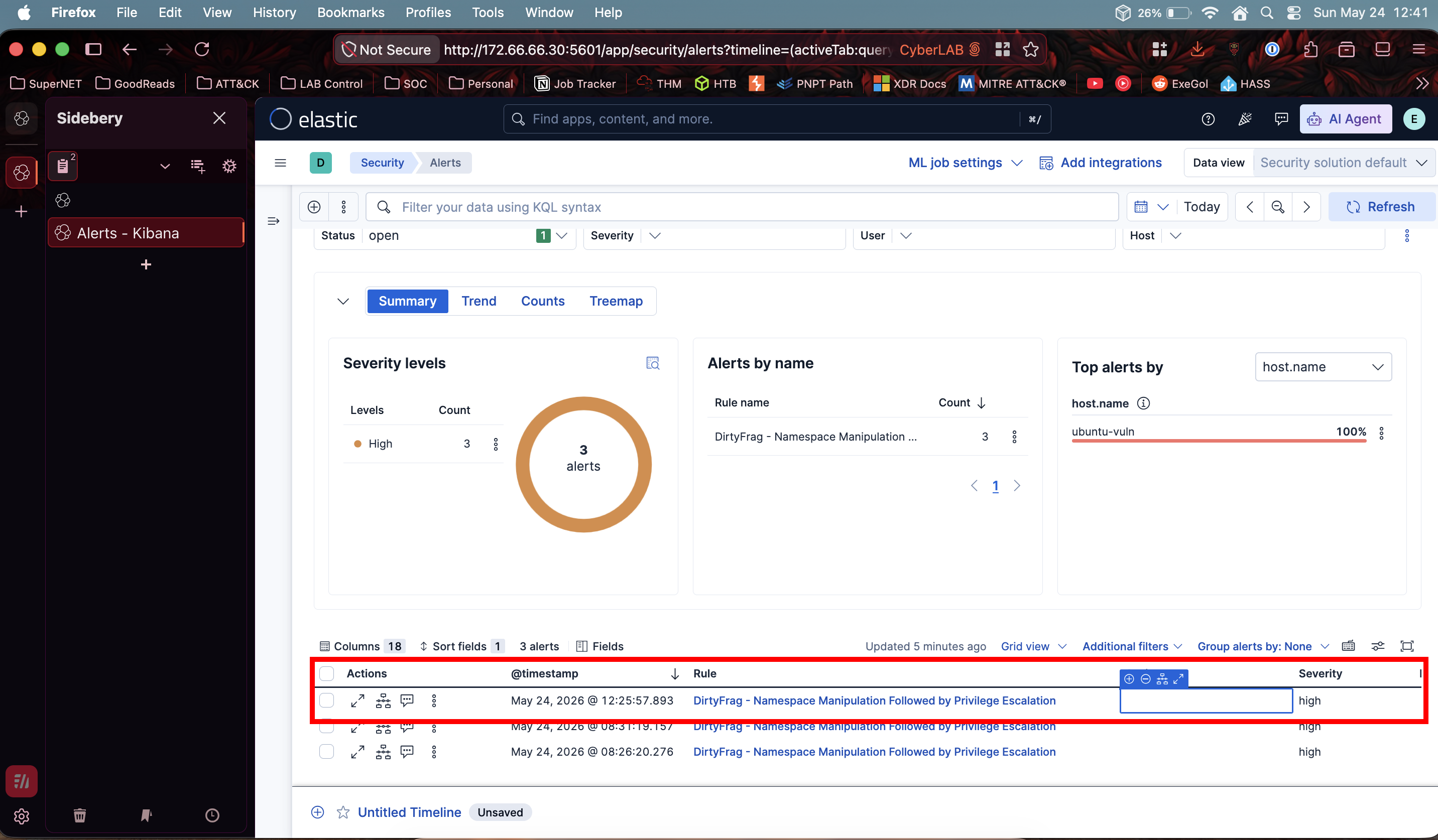 تفاصيل تنبيه Kibana - درجة المخاطرة 73، الحالة مفتوحة